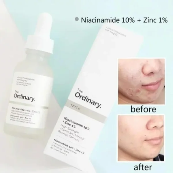 Skin Brightening Niacinamide Serum - Image 3